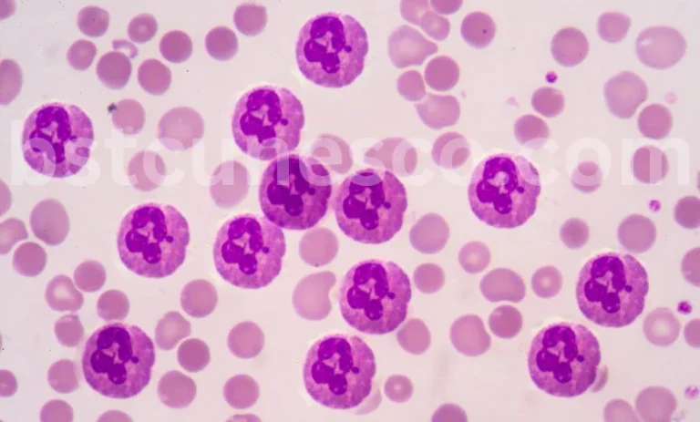 بازبرنامهریزی سیستم پاکسازی بدن: نقش علوم پایه در درمانهای نوین در باشگاه علوم پایه و فناوری یونسکو